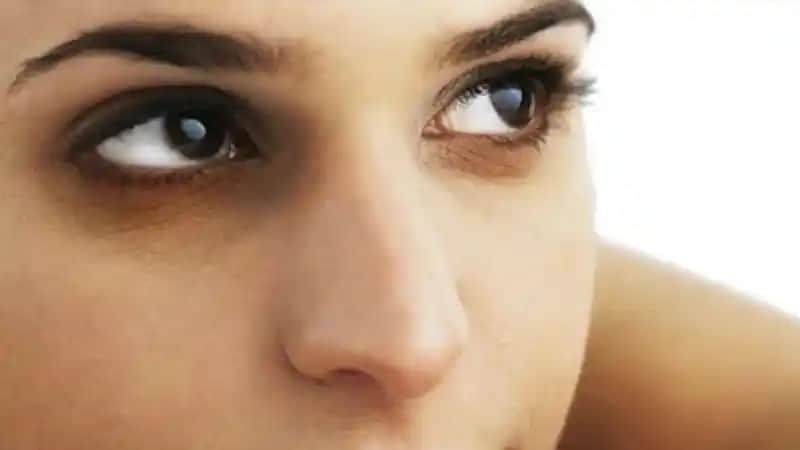 Göz Altı Morarması Nedenleri ve Etkili Tedavi Yöntemleri Hakkında Bilgiler