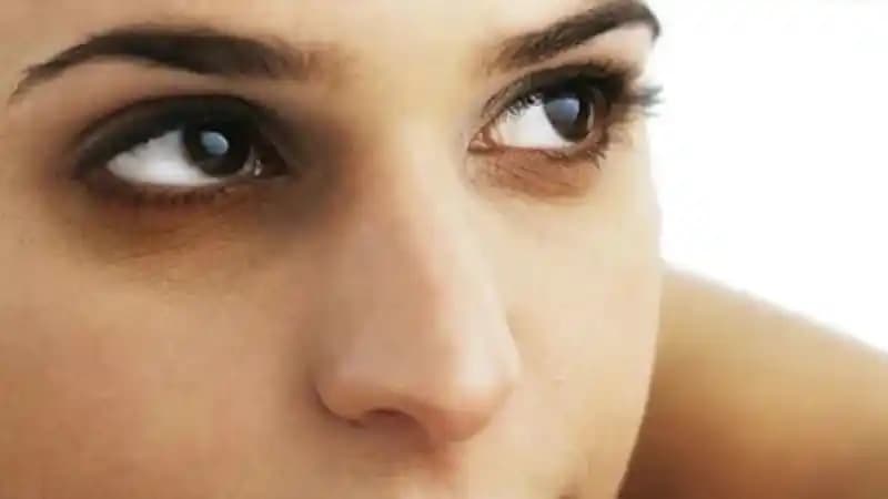 Göz Altı Morarması Nedenleri ve Etkili Tedavi Yöntemleri Hakkında Bilgiler