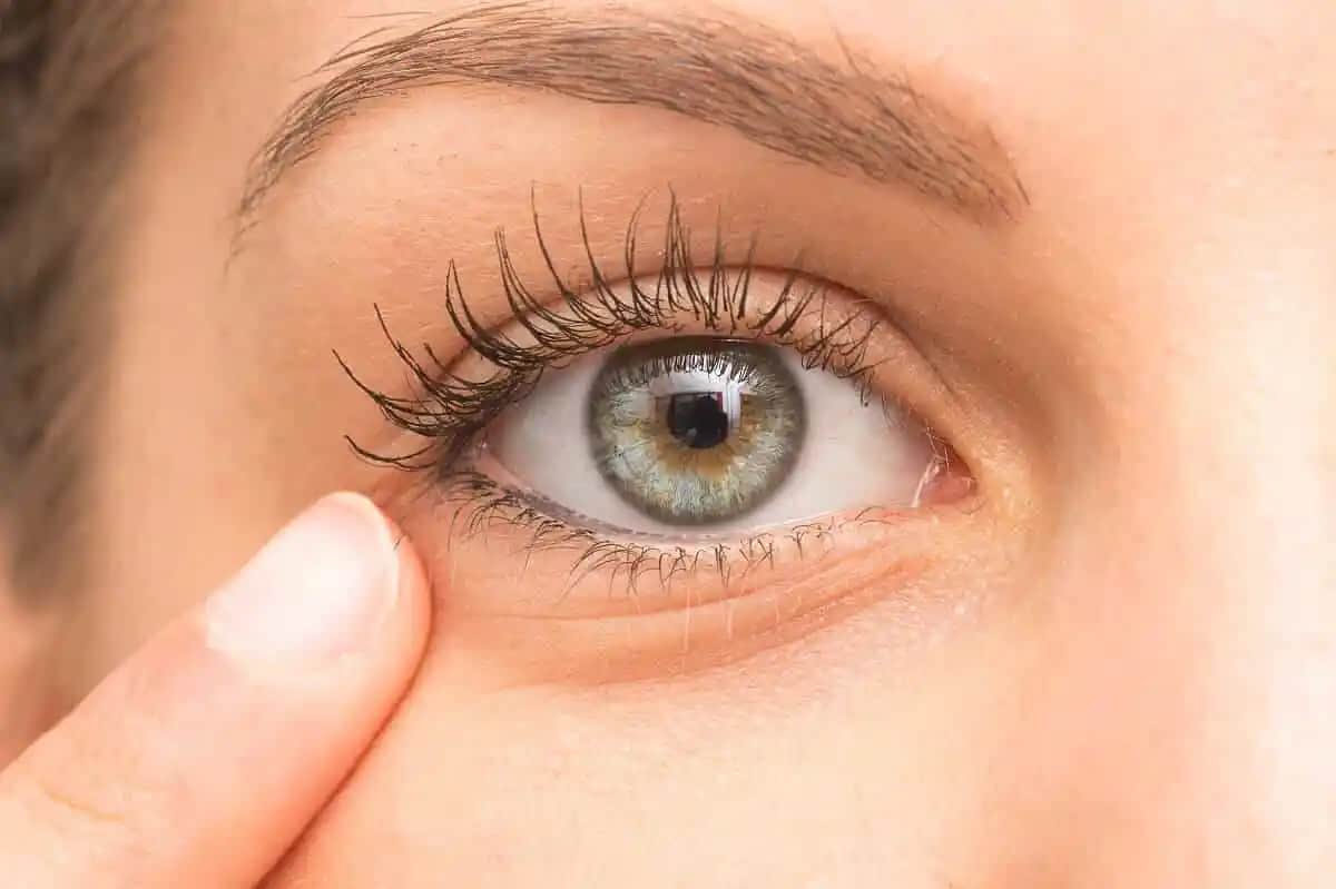 Göz Altı Morlukları Nasıl Geçer: Kozmetik ve Doğal Çözümlerle Etkili Yöntemler