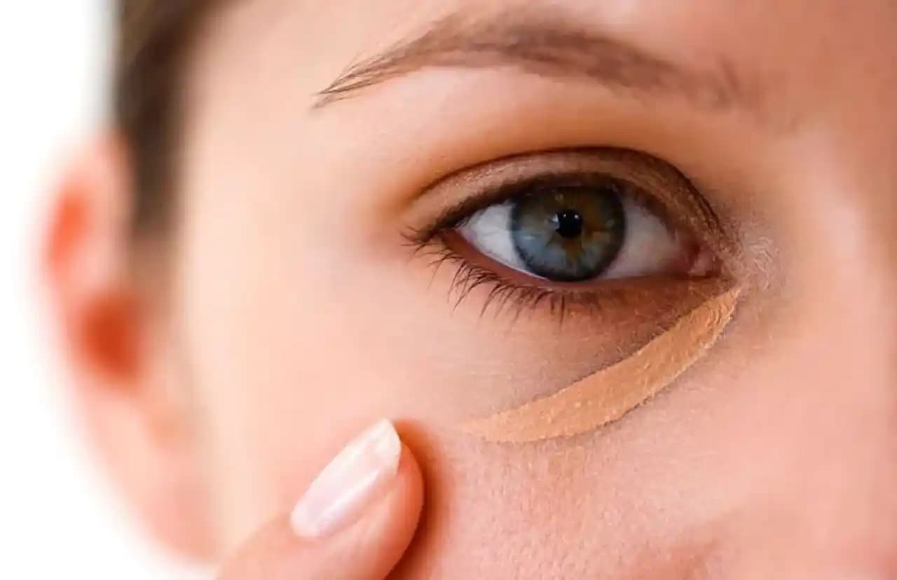 Göz Altı Morluklarına Karşı En Etkili Çözüm Yolları ve Uzman Tavsiyeleri