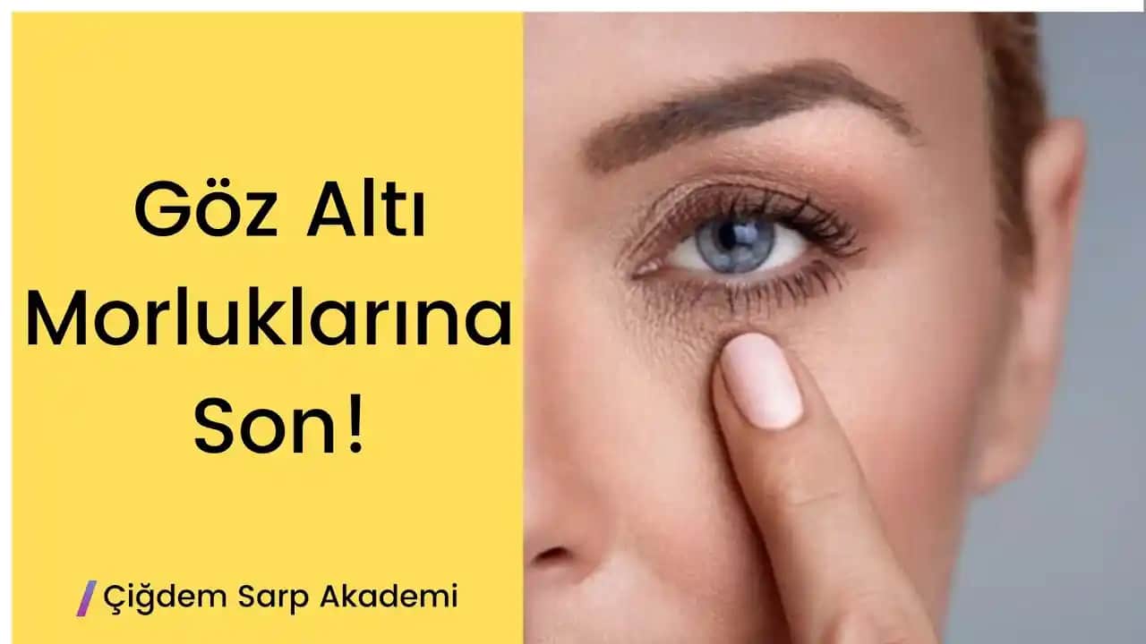 Göz Altı Morluklarını Azaltma Yöntemleri ve Günlük Bakım İpuçları