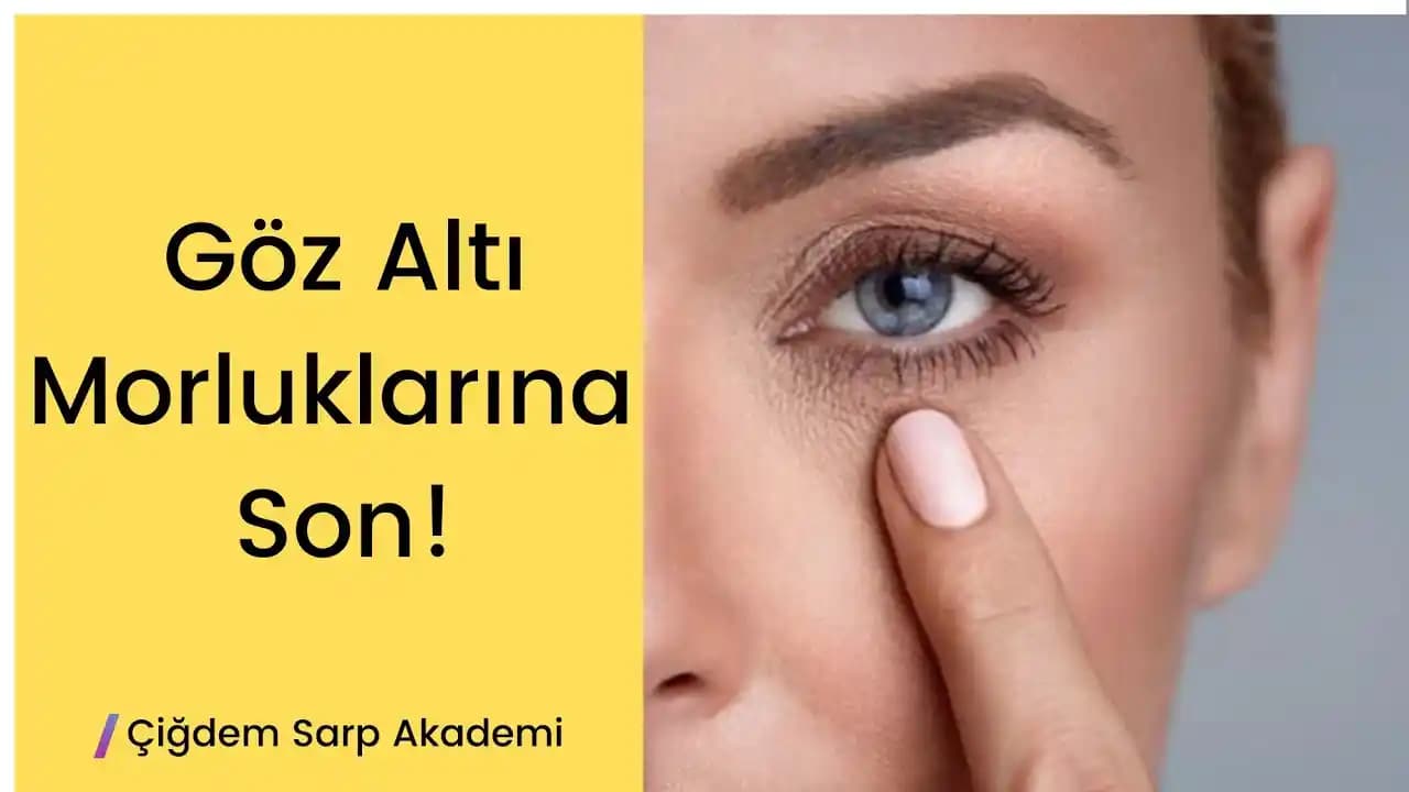 Göz Altı Morluklarını Azaltma Yöntemleri ve Günlük Bakım İpuçları