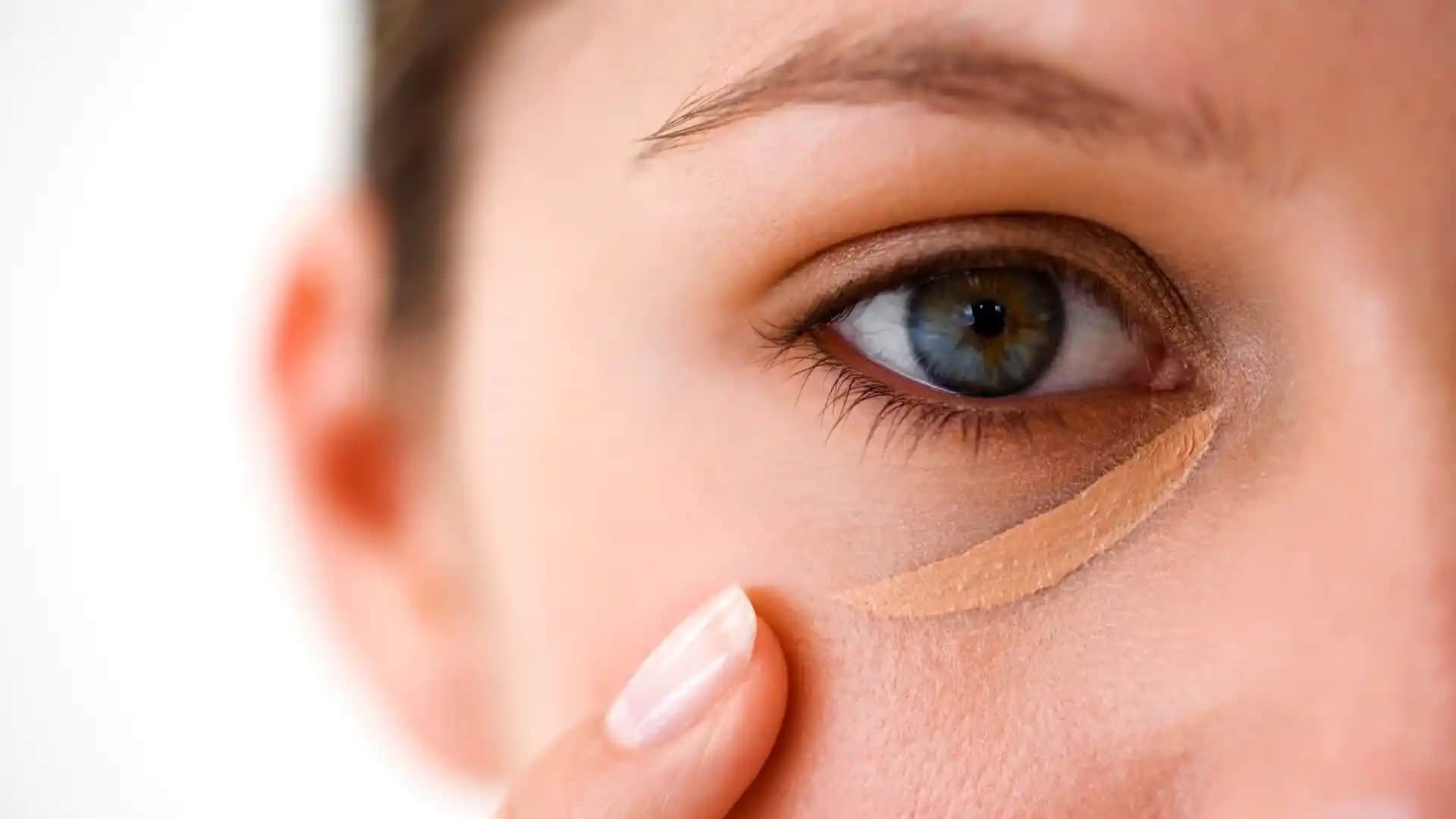 Göz Altı Morluklarını Azaltmak İçin Doğal, Kozmetik ve Tıbbi Yaklaşımlar