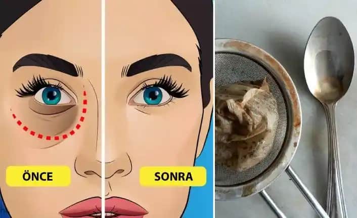 Göz Altı Şişliği Nasıl Geçer: Doğal ve Kozmetik Çözüm Yöntemleri