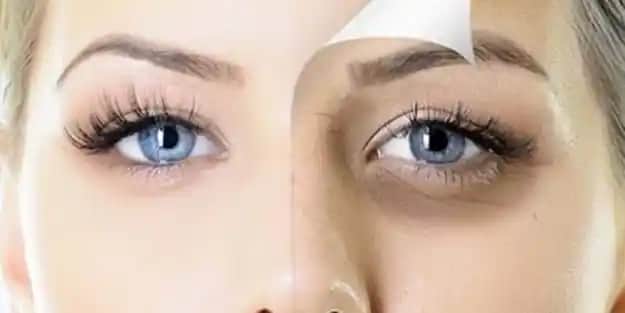 Göz Altı Şişliklerine Karşı Etkili Çözüm Yöntemleri ve Cilt Sağlığı İpuçları