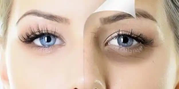 Göz Altı Şişliklerine Karşı Etkili Çözüm Yöntemleri ve Cilt Sağlığı İpuçları