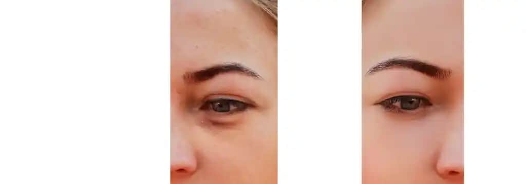 Göz Çevresi Aydınlatma Teknikleri ve Doğru Bakım Yöntemleri Hakkında Kapsamlı Rehber