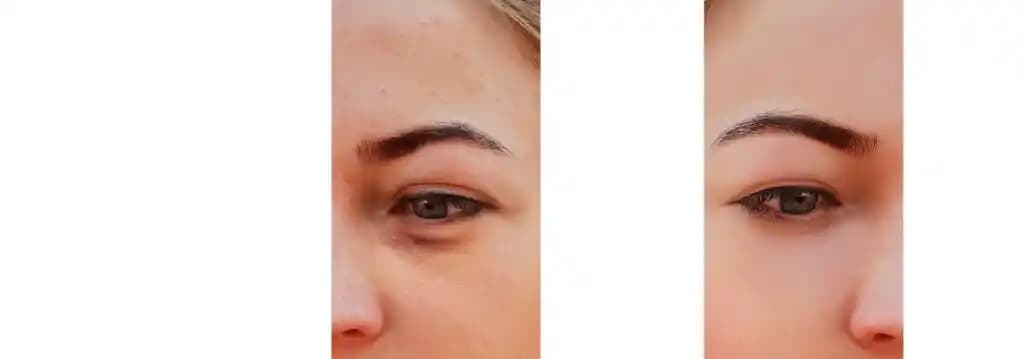 Göz Çevresi Aydınlatma Teknikleri ve Doğru Bakım Yöntemleri Hakkında Kapsamlı Rehber