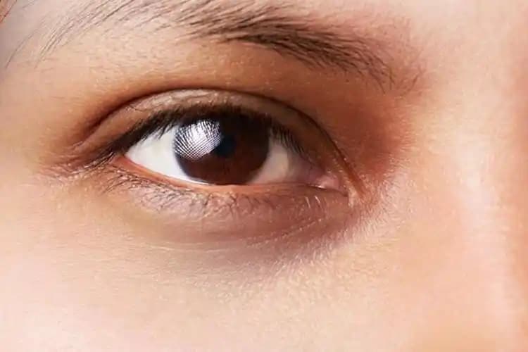 Göz Çevresi Kararmasının Nedenleri ve Etkili Bakım Yöntemleri