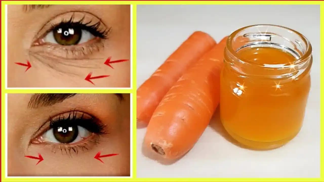 Göz Çevresi Kırışıklıklarını Azaltma ve Genç Görünüm İçin Etkili Yöntemler