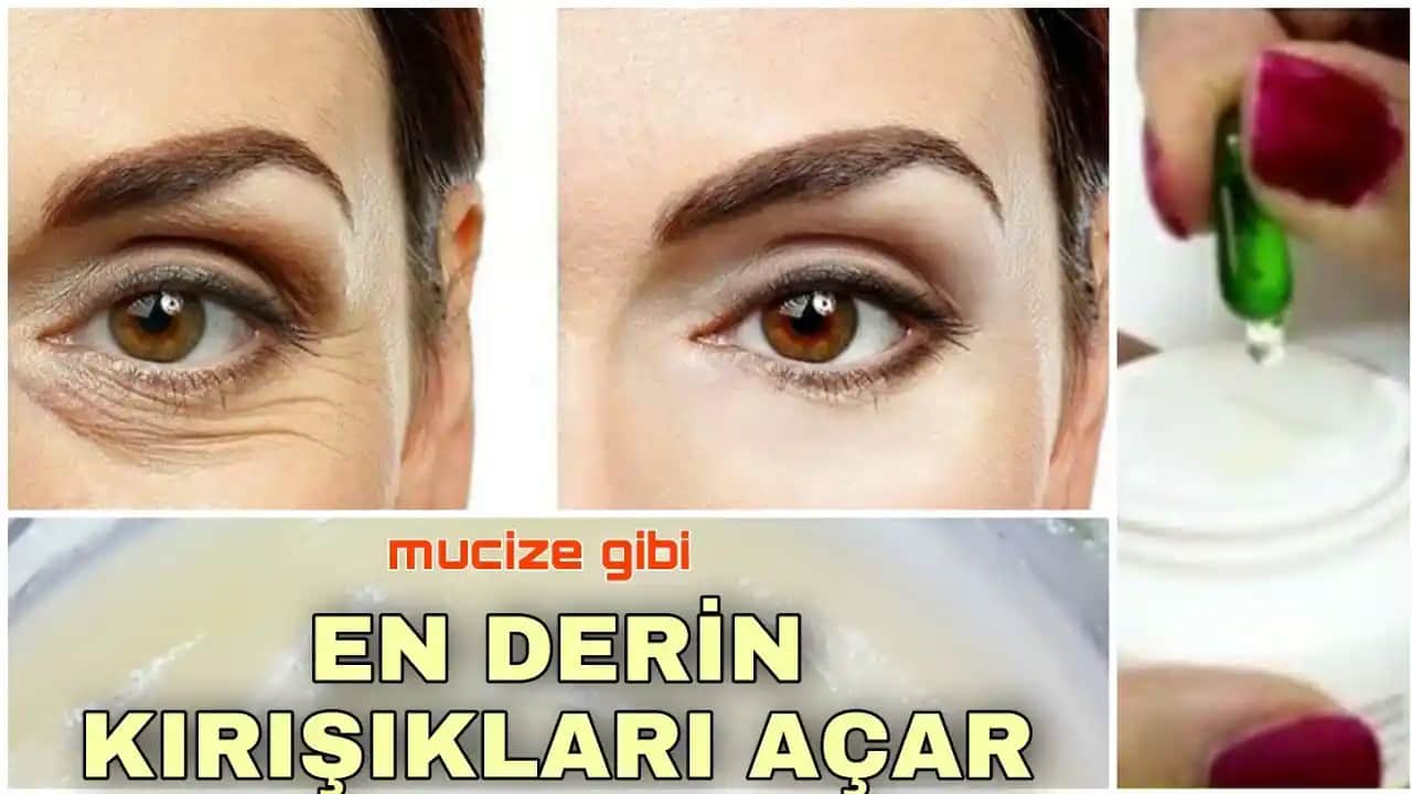 Göz Çevresi Kırışıklıklarını Gidermenin Etkili Yolları ve Bakım İpuçları