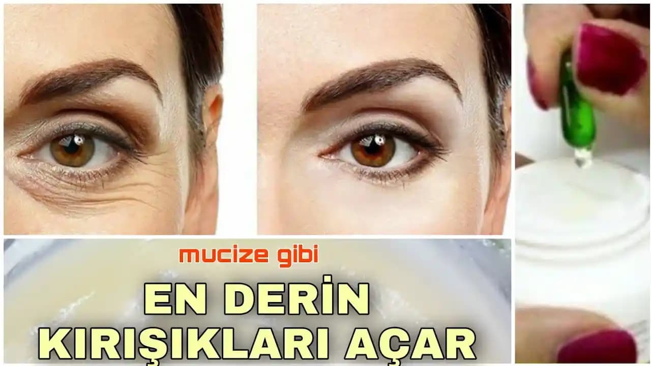 Göz Çevresi Kırışıklıklarını Gidermenin Etkili Yolları ve Bakım İpuçları
