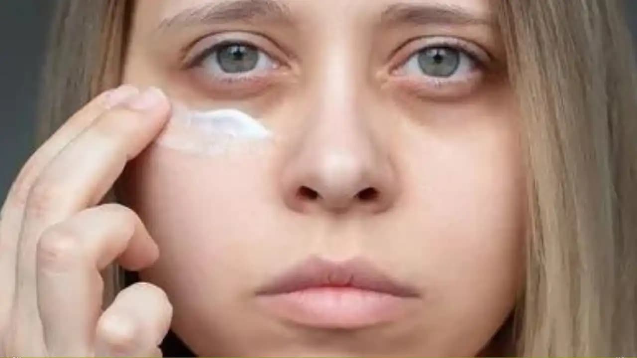 Göz Çevresi Morluklarına Karşı Etkili Yöntemler ve Doğal Çözüm Tavsiyeleri