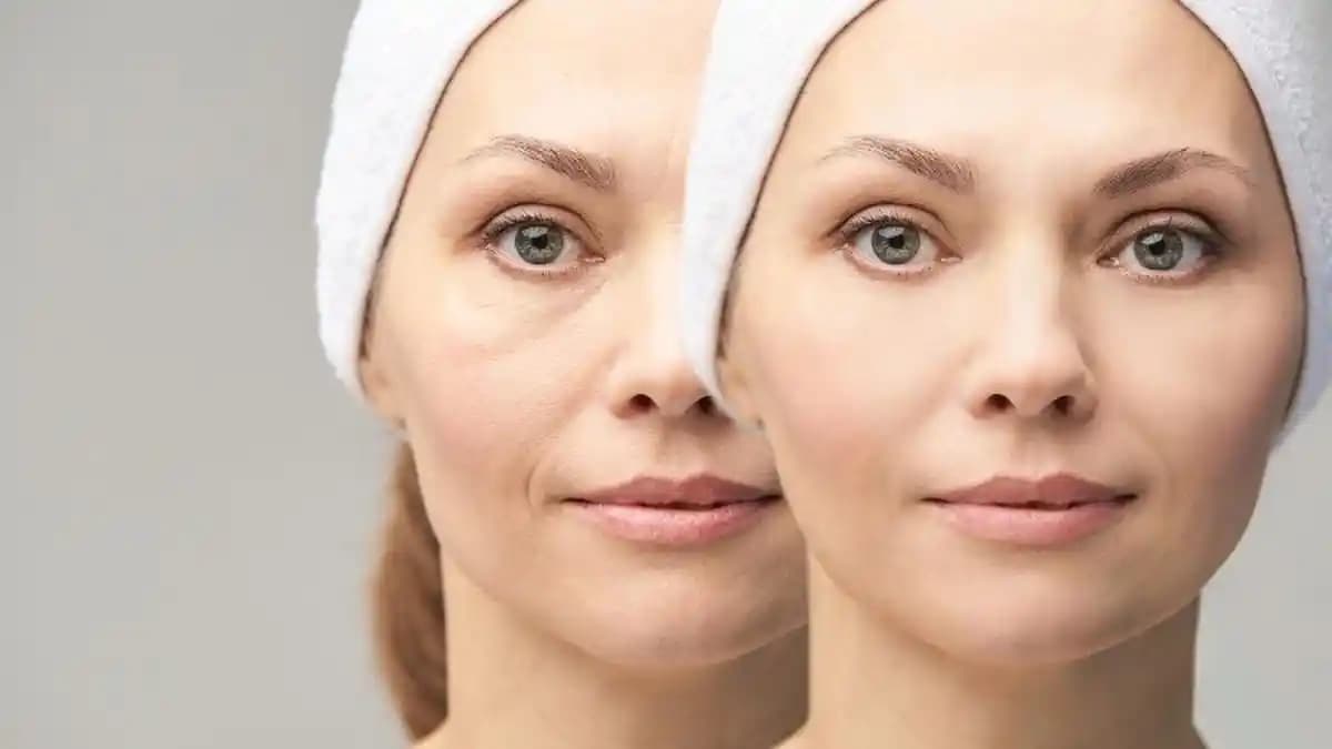 Göz Kırışıklıklarına Karşı Etkili Doğal ve Kozmetik Yöntemler ve Cilt Sağlığı Tavsiyeleri