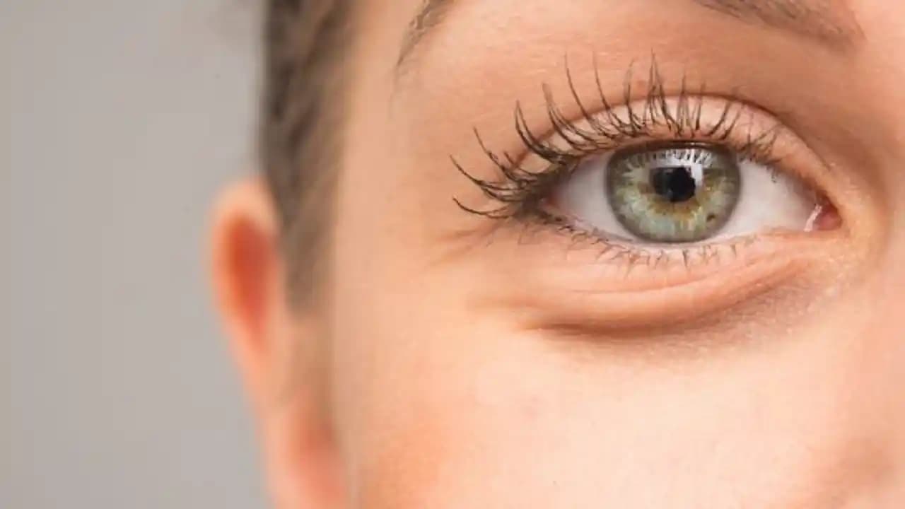 Göz Torbaları Neden Oluşur ve Kozmetik Çözüm Yöntemleri Nelerdir