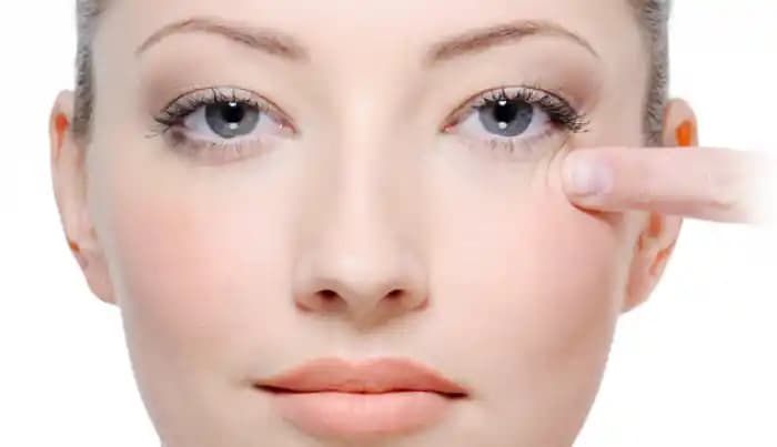 Gözaltı Çizgileri Nasıl Geçer En Etkili Yöntemler ve Günlük Bakım İpuçları