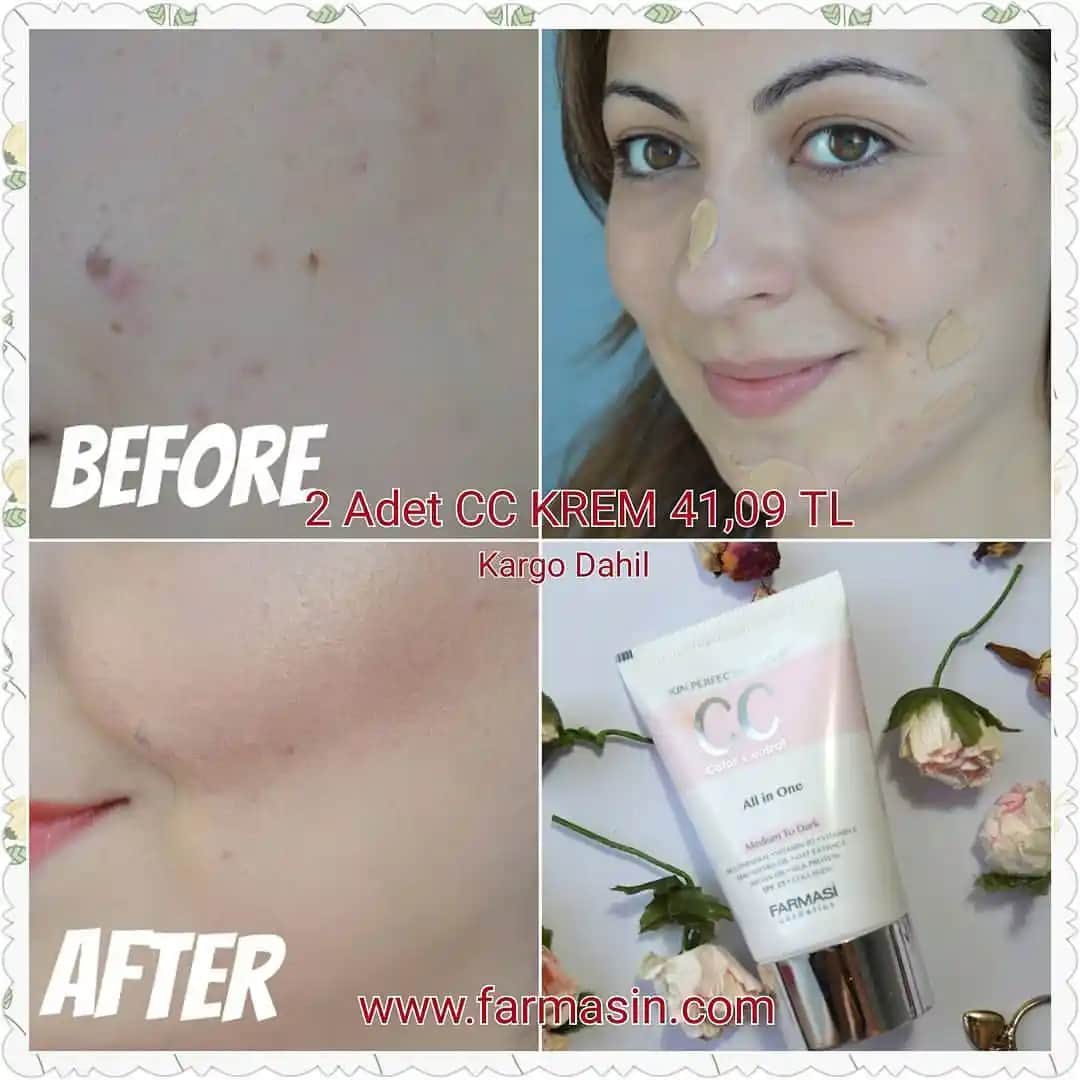 Gözenekleri Kapatan Kremler ve Cilt Sıkılaştırıcı Ürünler Hakkında Detaylı Rehber