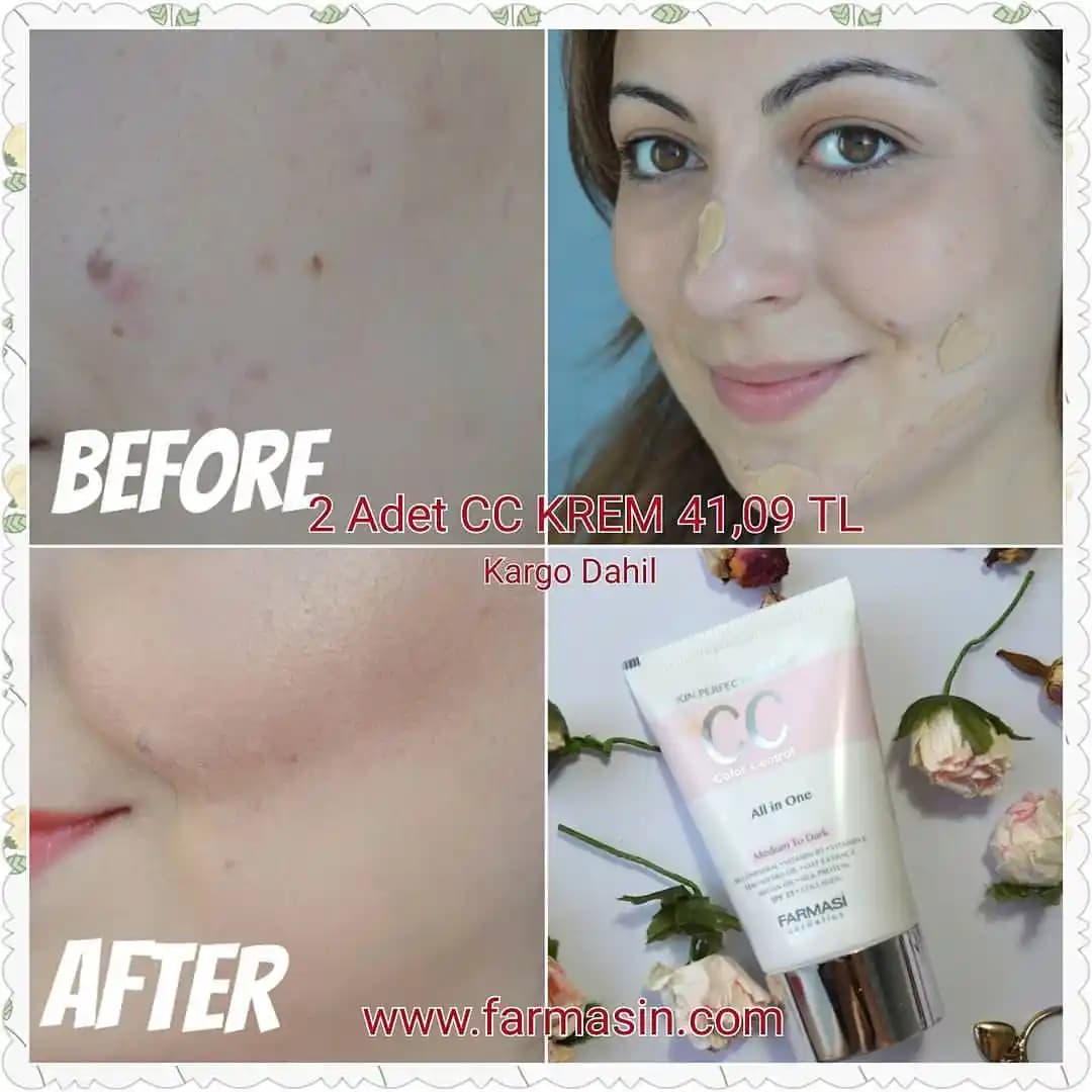 Gözenekleri Kapatan Kremler ve Cilt Sıkılaştırıcı Ürünler Hakkında Detaylı Rehber