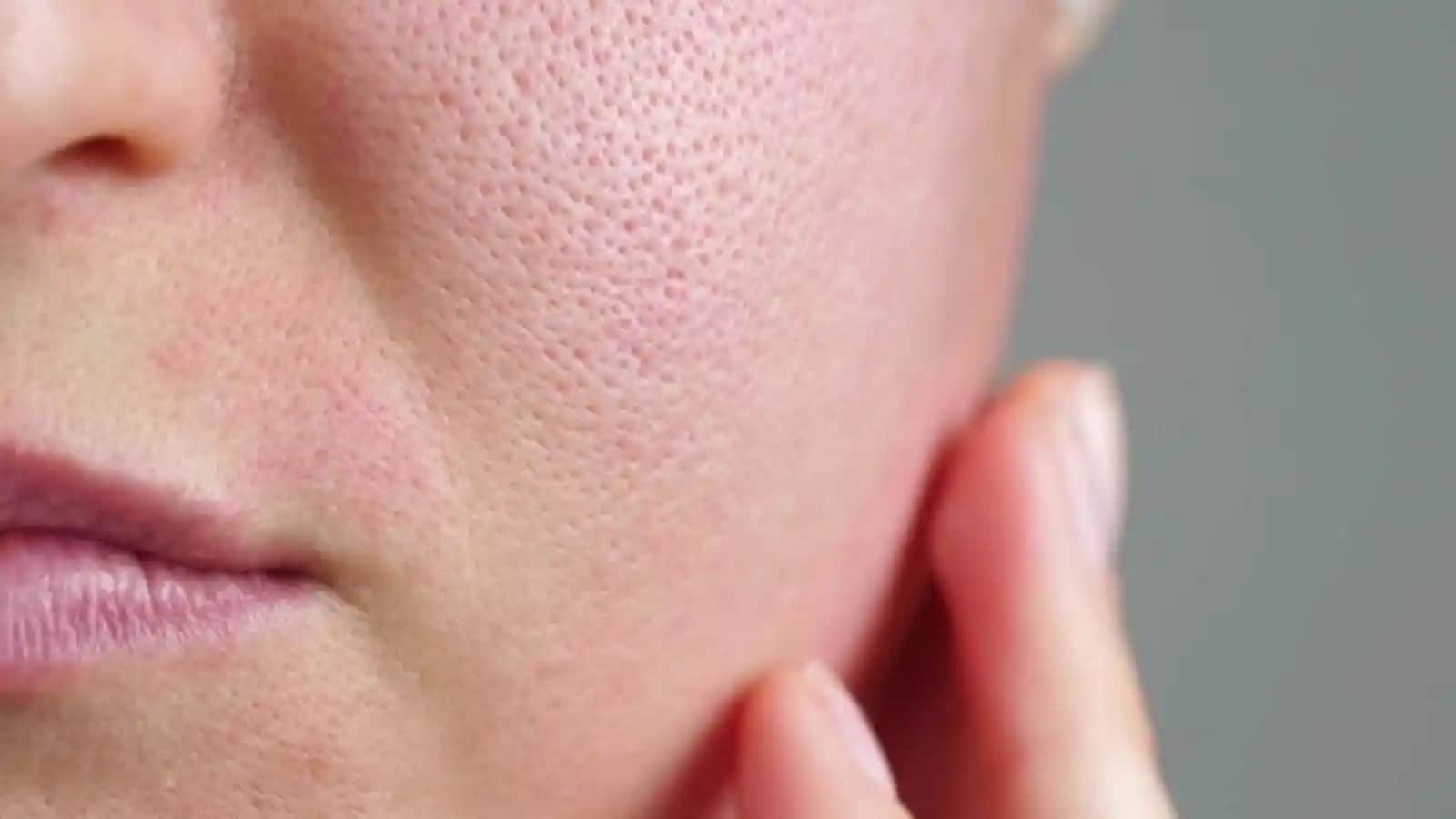 Gözeneklerin Neden Büyüdüğü ve Kontrol Altına Alınması Yöntemleri Hakkında Kapsamlı Rehber