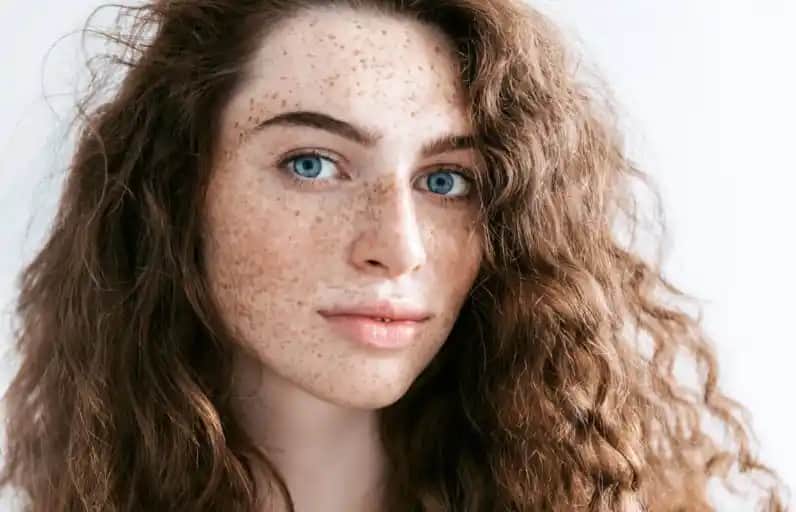 Güneş Lekeleriyle Mücadele ve Önleme Yöntemleri: Etkili Çözüm ve Cilt Sağlığı İpuçları