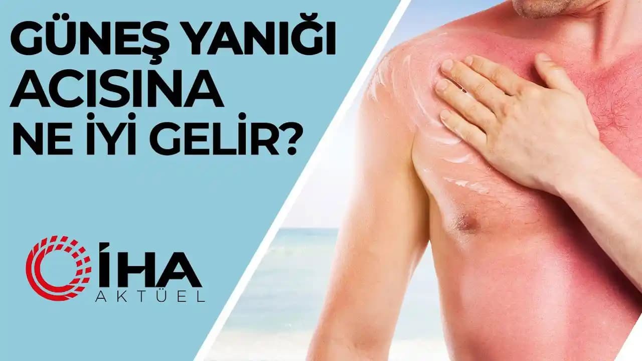 Güneş Yanığına İyi Gelen Yöntemler ve Cilt Sağlığını Korumak İçin Bilmeniz Gerekenler