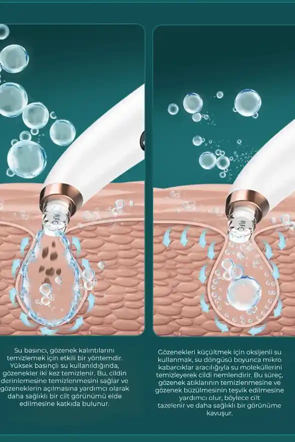 Güzellik Merkezlerinde Siyah Nokta Temizliği Fiyatları ve Uygulama Detayları