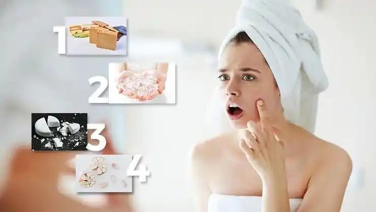 Hızlı Sivilce Geçirme Yöntemleri ve Doğru Bakım İpuçları