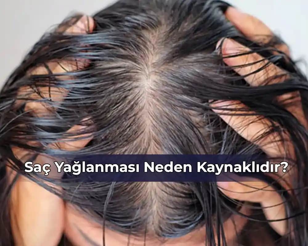 Hormonel Saç Yağlanmasının Nedenleri ve Sağlıklı Saçlar İçin Çözüm Yolları