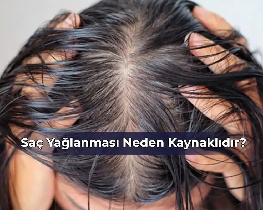 Hormonel Saç Yağlanmasının Nedenleri ve Sağlıklı Saçlar İçin Çözüm Yolları