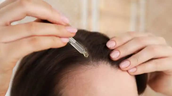 Kafa Derisindeki Egzama İçin En Etkili Doğal ve Tıbbi Çözüm Yöntemleri