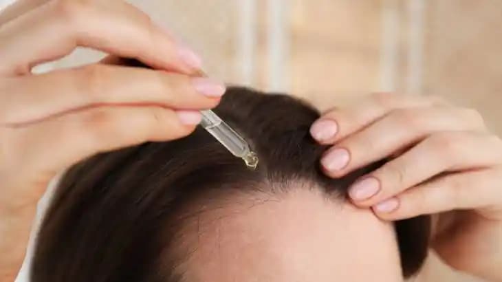 Kafa Derisindeki Egzama İçin En Etkili Doğal ve Tıbbi Çözüm Yöntemleri