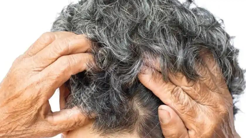 Kafa Kaşıntısının Nedenleri ve Etkili Tedavi Yöntemleri Hakkında Bilmeniz Gerekenler