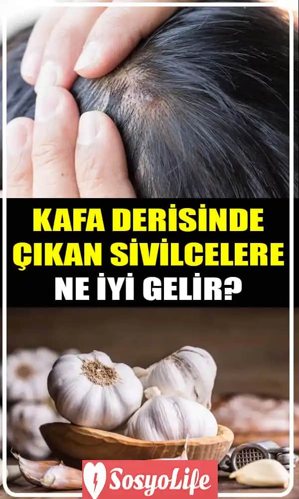 Kafa Yaralarına Yönelik Doğal ve Kozmetik İyileşme Yöntemleri ve Bakım Tavsiyeleri