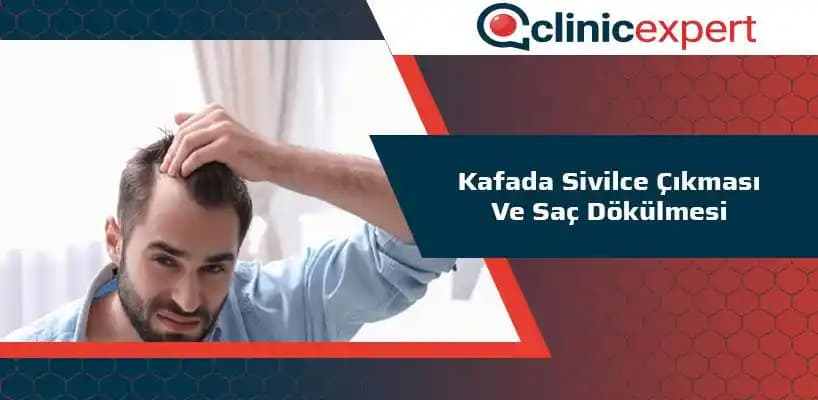 Kafada Şişlik ve Saç Dökülmesi: Sebepleri ve Kozmetik Çözüm Yöntemleri