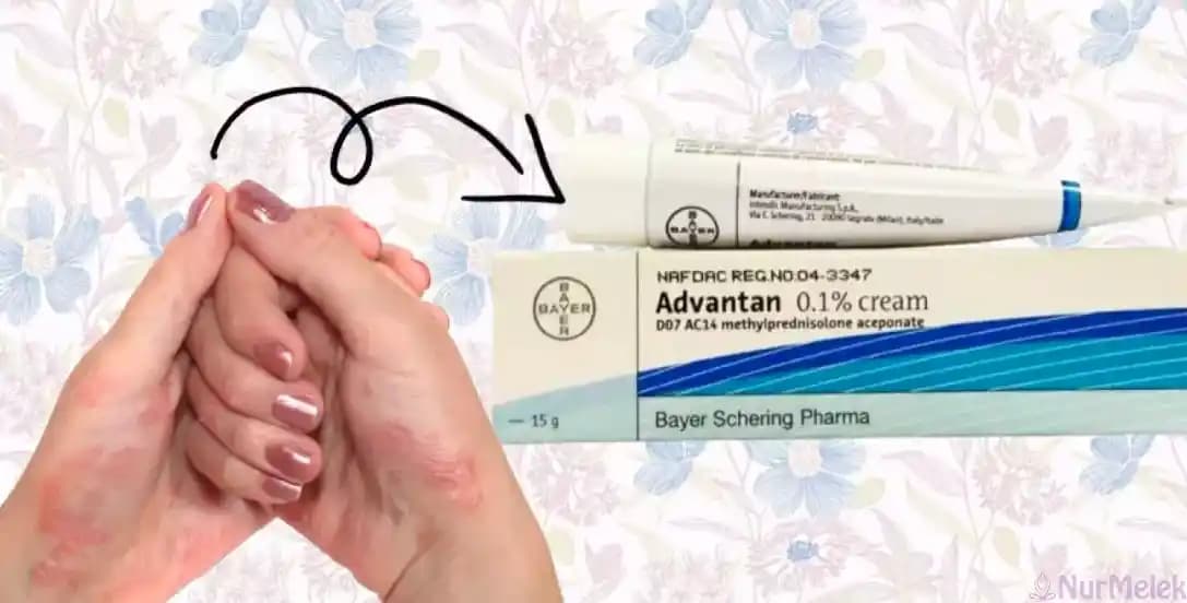 Kahverengi Yanık İzleri İçin En Etkili Krem Seçenekleri ve Doğal Çözümler