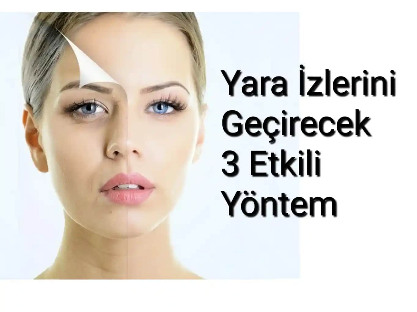 Kahverengi Yara İzleri Nasıl Geçer? Etkili Yöntemler ve Uzman Tavsiyeleri