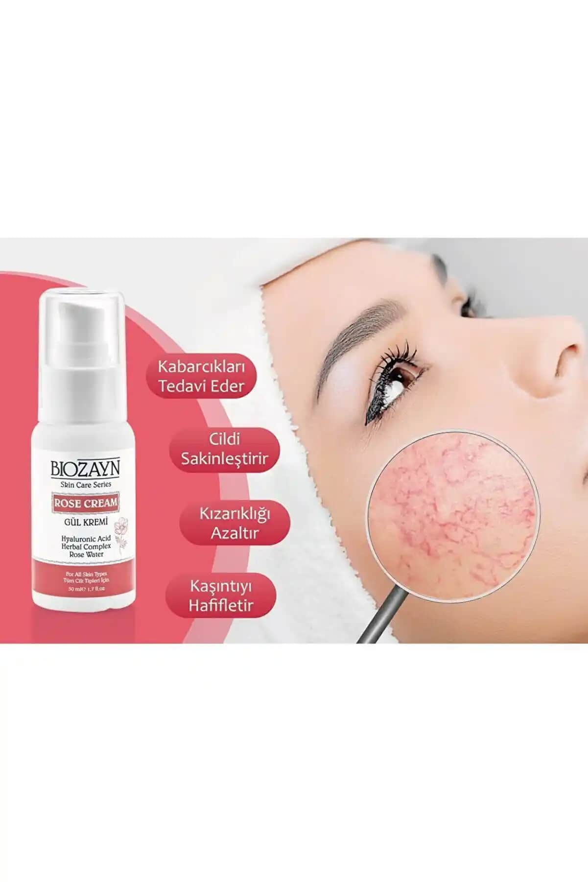 Kapari Kremi ve Gül Hastalığı: Doğal İçeriklerle Cilt Sağlığını Koruma Yöntemleri