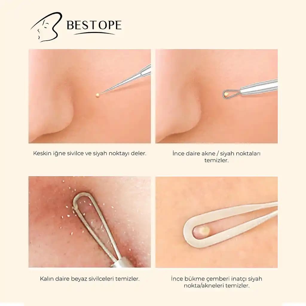Kara Nokta Temizleme Yöntemleri ve Cilt Sağlığını Koruma İpuçları