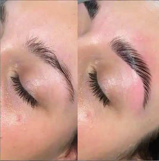 Kaş Laminasyonu Nedir ve Kimler İçin Uygundur Güvenli Uygulama Yöntemleri