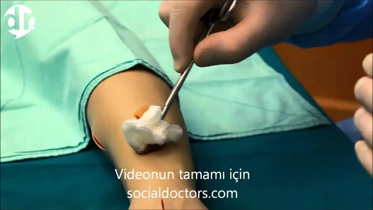 Kese Atma Nedir ve Cilt Sağlığına Faydaları Nelerdir