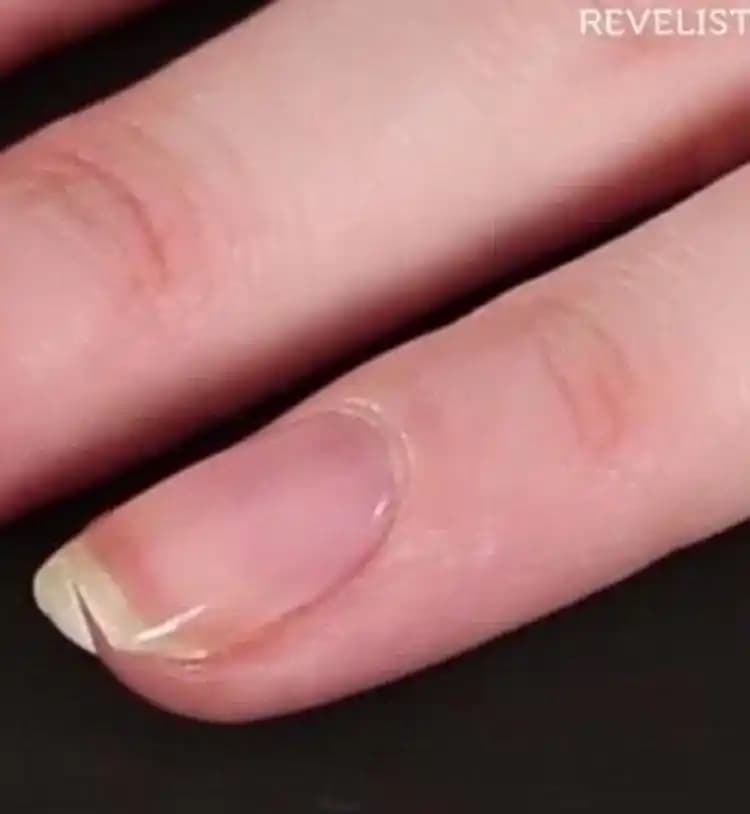 Kırık Tırnaklar ve Sağlıklı Tırnak Bakımı Yöntemleri Hakkında Detaylı Bilgi