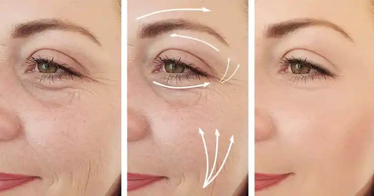 Kırışıklarla Mücadelede Güncel Yaklaşımlar ve Etkili Bakım Yöntemleri