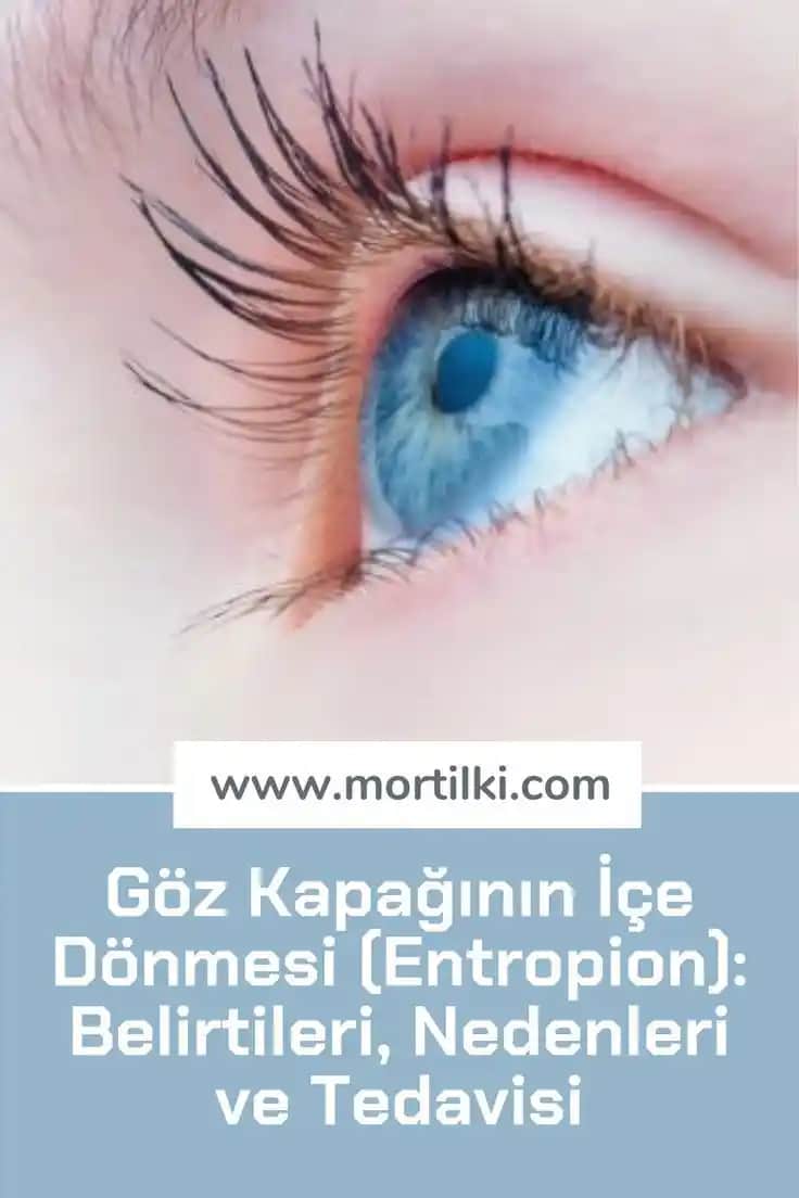 Kirpik Beyazlaması Nedenleri ve Etkili Tedavi Yöntemleri Hakkında Detaylı Bilgi