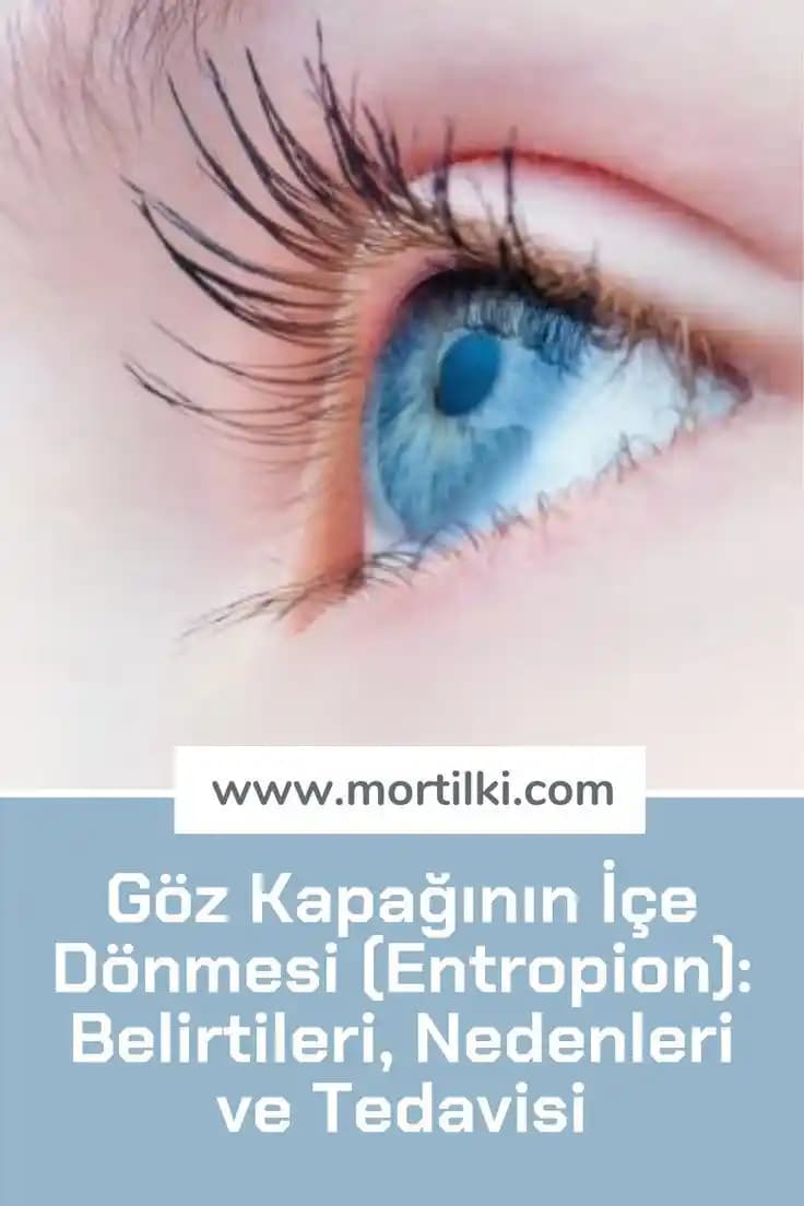 Kirpik Beyazlaması Nedenleri ve Etkili Tedavi Yöntemleri Hakkında Detaylı Bilgi