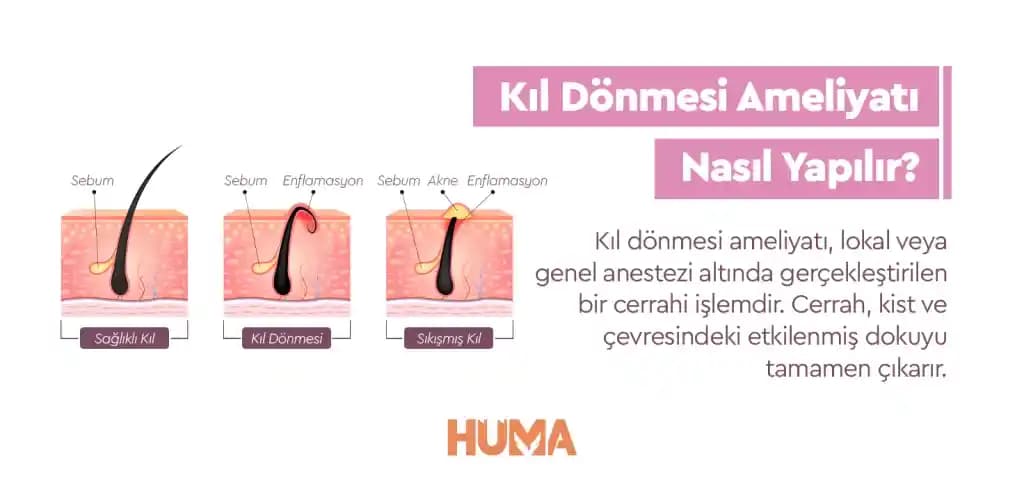 Kolda Kıl Dökülmesinin Nedenleri ve Etkili Önlemler Hakkında Bilgi