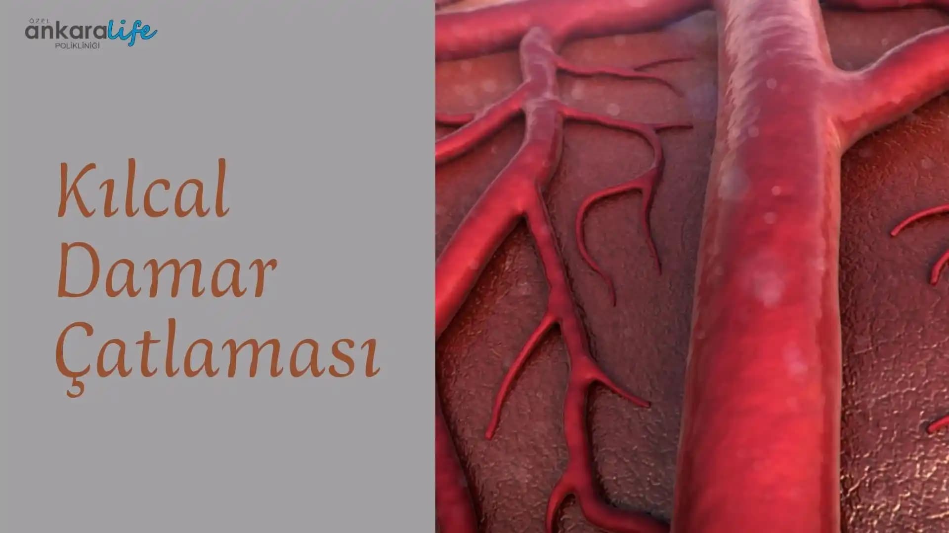 Kolda Kılcal Damar Çatlaması Nedenleri, Belirtileri ve Etkili Çözüm Yöntemleri