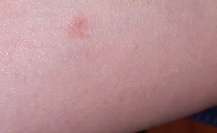 Kolda Yeşil Leke Nedenleri, Belirtileri ve Etkili Tedavi Yöntemleri