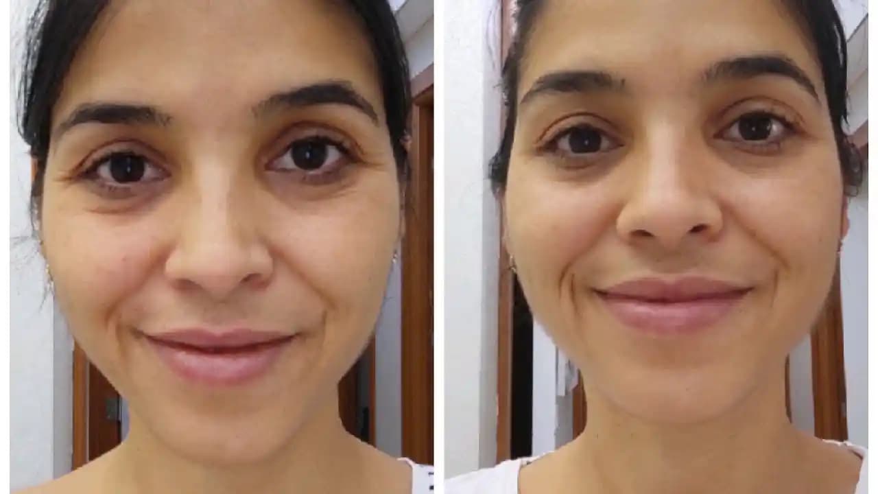 Kollajen Kullanımı Öncesi ve Sonrası: Cilt Sağlığında Etkili Yaklaşımlar ve İpuçları