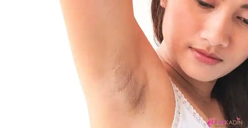 Koltuk Altı Kararması Nedenleri ve Etkili Bakım Yöntemleri Hakkında Detaylı Bilgi