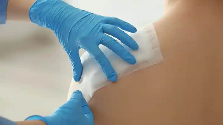 Kozmetik Ameliyat Sonrası Dikişlerin Kaşınması ve Bakım İpuçları